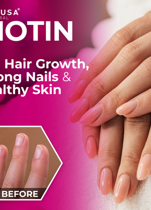 HallBiotin - Biotin 10000mcg - Hair Skin and Nails Vitamins - Hair Growth Vitamins for Women - 60 Capsules - Hallusa Natural