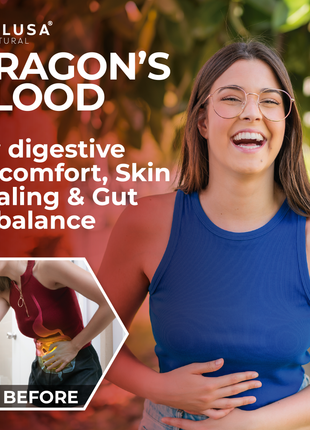 DRAGON´S BLOOD CROTON LECHLERI